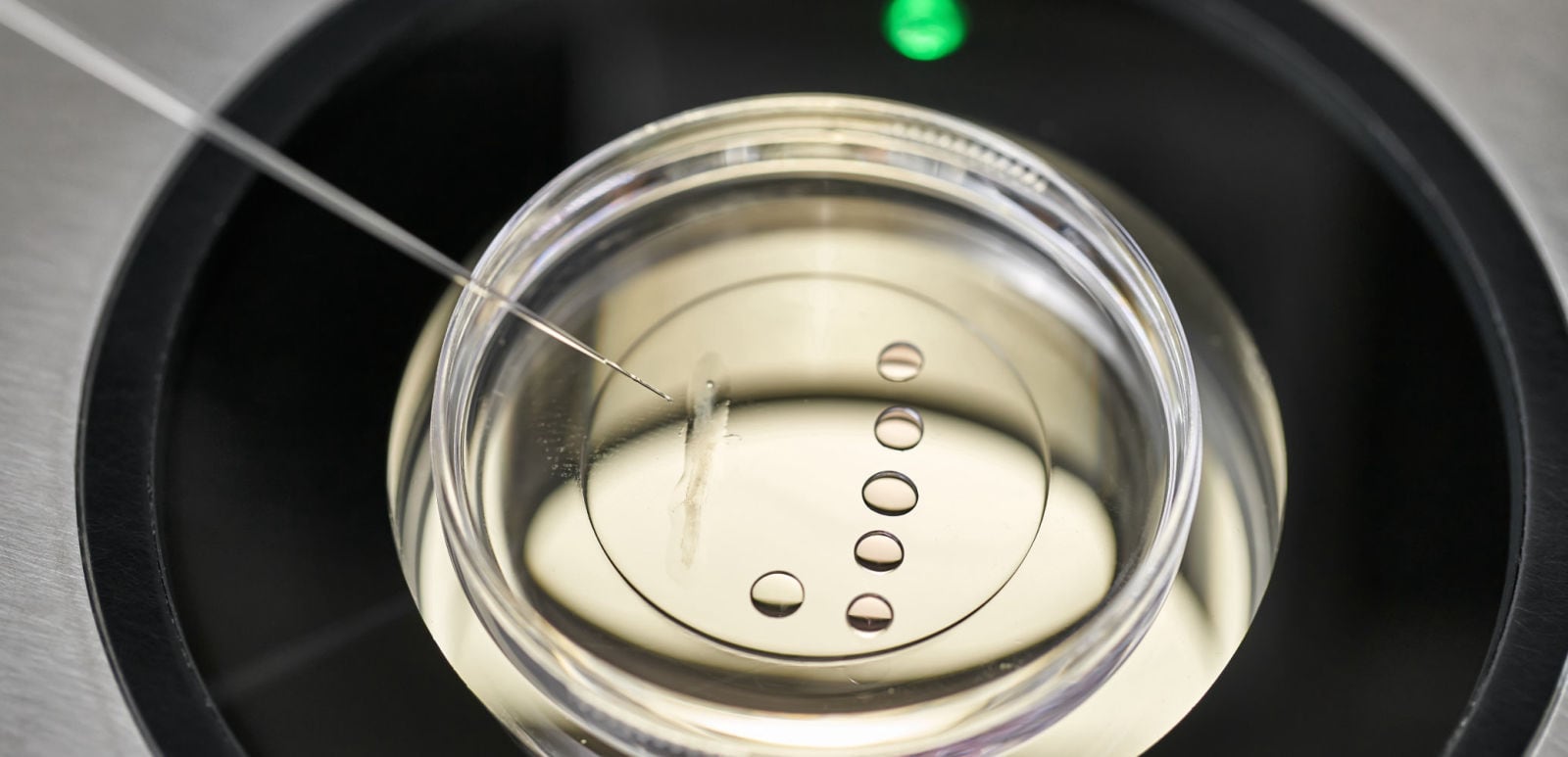 Close-up view of an IVF procedure with a needle and petri dish, representing fertility preservation and treatment.