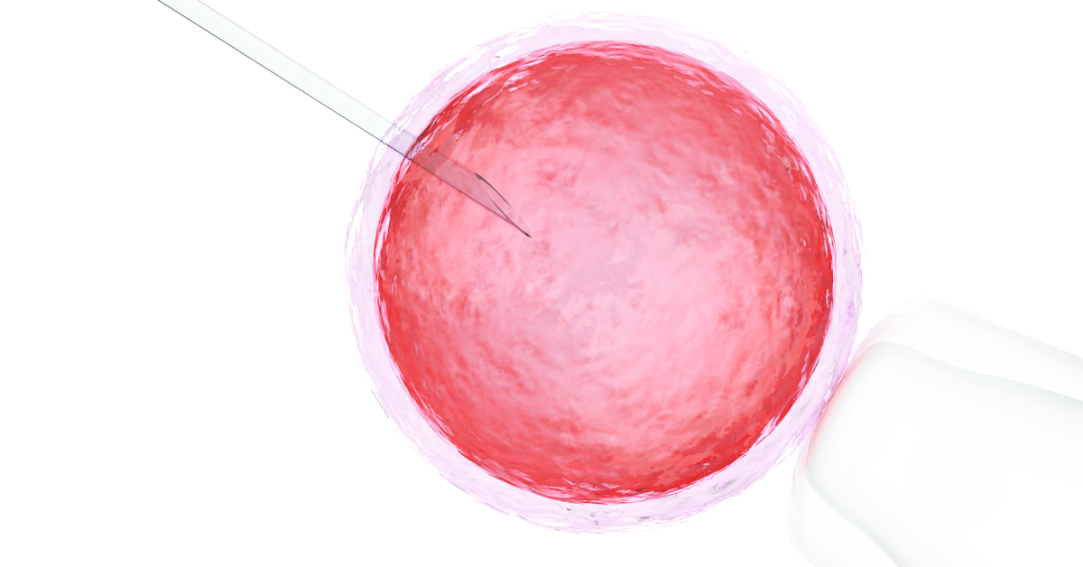 A graphic representation of the in vitro fertilization egg retrieval procedure, displaying a needle extracting an oocyte from an ovarian follicle.